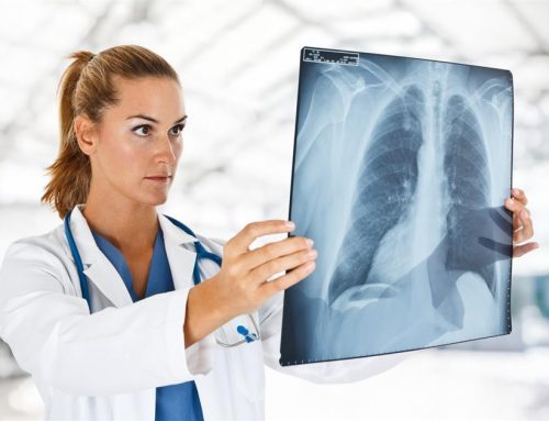 ¿En qué consiste el examen de tomografía?