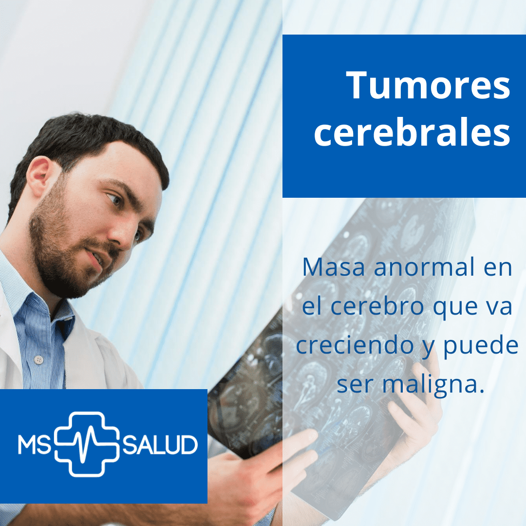 tumor cerebral 3 tumor cerebral 3