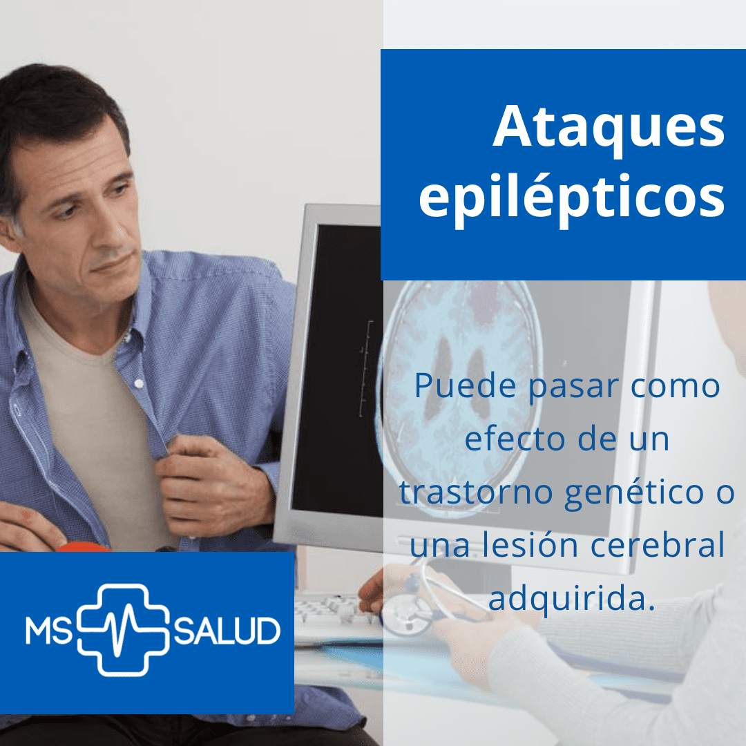 Ataques epilépticos Electroencefalograma MS Mas Salud