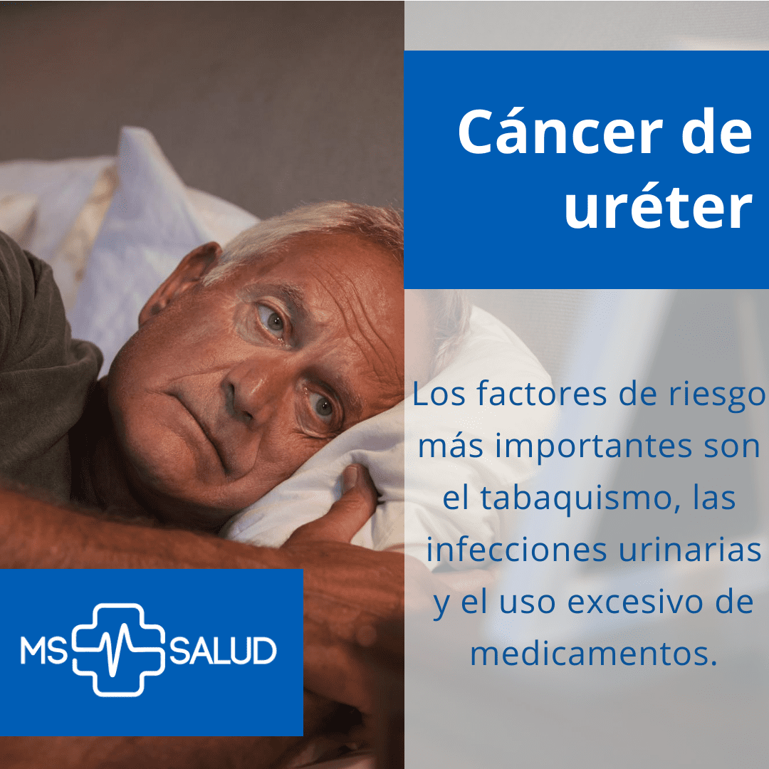 cancer de ureter 2